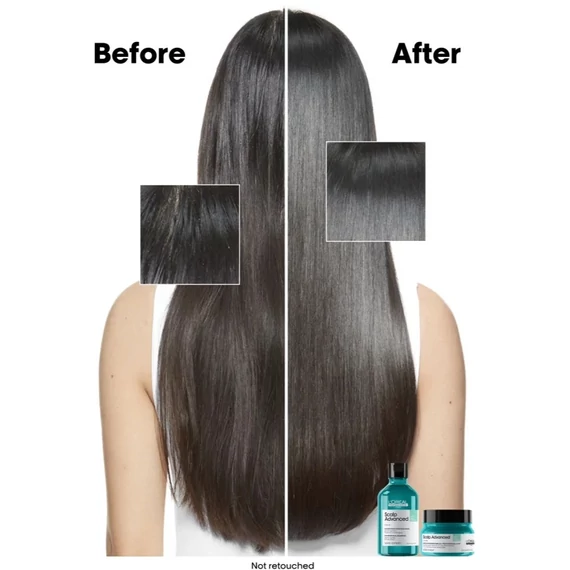 Loreal Scalp Advanced 2in1 mélytisztító sampon és pakolás zsíros hajra, 500 ml