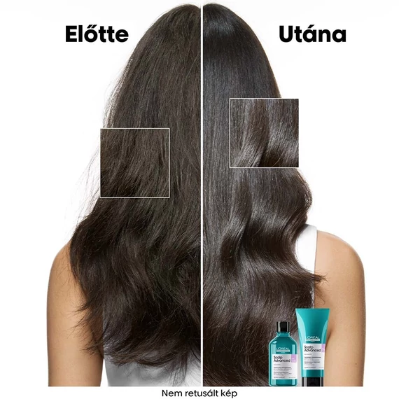 Loreal Scalp Advanced nyugtató sampon érzékeny fejbőrre, 300 ml