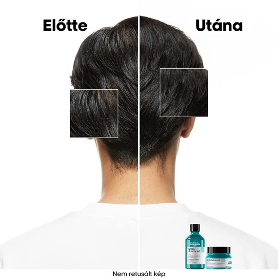Loreal Scalp Advanced nyugtató sampon érzékeny fejbőrre, 300 ml