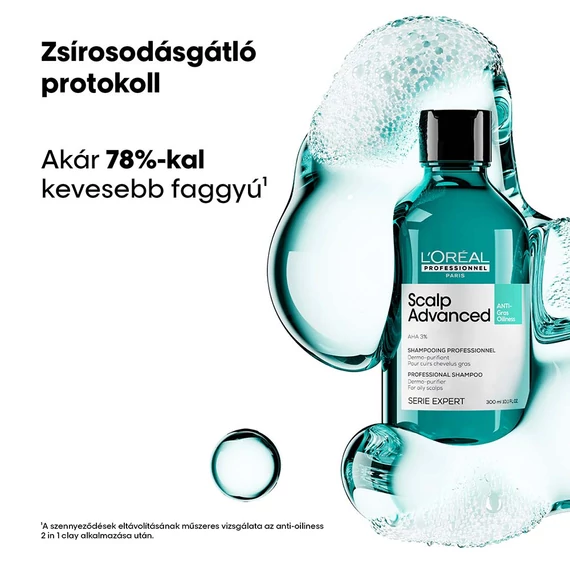 Loreal Scalp Advanced sampon zsíros hajra, 300 ml