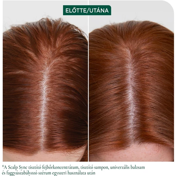 Matrix Biolage ScalpSync Clarifying mélytisztító sampon, 400 ml