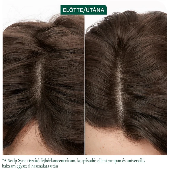 Matrix Biolage ScalpSync Dandruff Control korpásodás elleni sampon, 400 ml