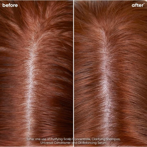 Matrix Biolage ScalpSync mélytisztító sampon, 1 l