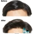 Loreal Scalp Advanced sampon zsíros hajra, 300 ml
